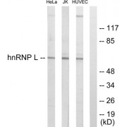 Western blot analysis of extracts from HeLa cells, Jurkat cells and HUVEC cells, using hnRNP L antibody.