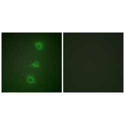 Serine/threonine-Protein Kinase B-Raf (B-RAF) Antibody