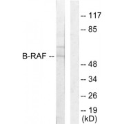 Western blot analysis of extracts from HeLa cells, using B-RAF antibody.