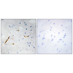 Transcription Factor E2-Alpha (TCF3) Antibody