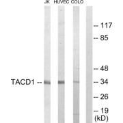 Western blot analysis of extracts from Jurkat cells, HuvEc cells and COLO205 cells, using TACD1 antibody.