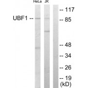 Western blot analysis of extracts from HeLa cells and Jurkat cells, using UBF1 antibody.