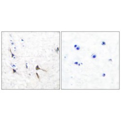 Potassium Channel Kv3.2b Antibody