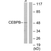 Western blot analysis of extracts from Jurkat cells, using CEBPB antibody.
