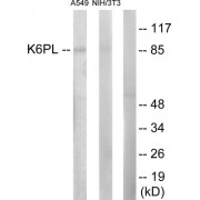 Western blot analysis of extracts from A549 cells and NIH-3T3 cells, using K6PL antibody.