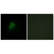 IF analysis of HepG2 cells, using Adrenergic Receptor alpha -2B antibody. The right image was blocked with the corresponding peptide.