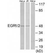 Western blot analysis of extracts from HeLa/Jurkat cells, using EGR1/2 antibody.