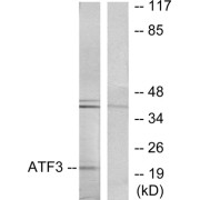 Western blot analysis of extracts from RAW264.7 cells, using ATF3 antibody.