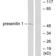 Western blot analysis of extracts from mouse heart cells, using presenilin 1 antibody.