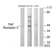 Western blot analysis of extracts from RAW264.7 cells, HT-29 cells and LOVO cells, using TNF Receptor II antibody.