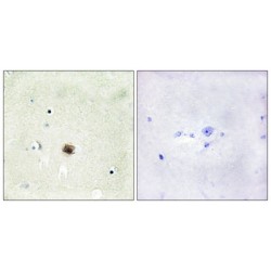 Cysteine And Glycine Rich Protein 1 (CSRP1) Antibody