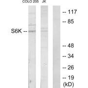 Western blot analysis of extracts from COLO205 cells and Jurkat cells, using S6K antibody.