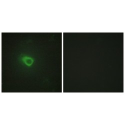Tyrosine-protein kinase JAK1 (JAK1) Antibody