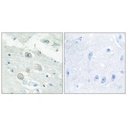 Immunohistochemistry analysis of paraffin-embedded human brain tissue, using JAK1 antibody.