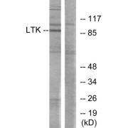 Western blot analysis of extracts from Jurkat cells, using LTK antibody.