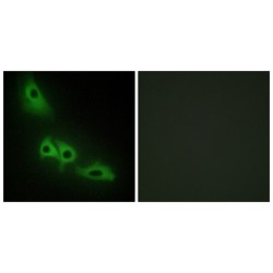 Glycerol Kinase (GK) Antibody