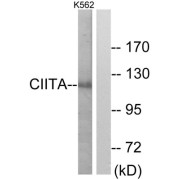 Western blot analysis of extracts from K562 cells, using CIITA antibody.