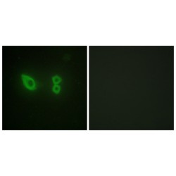 Actinin alpha 2 / 3 Antibody