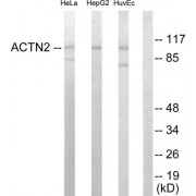 Western blot analysis of extracts from HeLa cells, HepG2 cells and HUVEC cells, using Actin alpha -2/3 antibody.