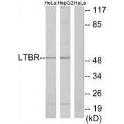 Western blot analysis of extracts from HeLa cells and HepG2 cells, using LTBR antibody.