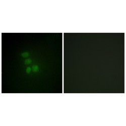 Heterogeneous Nuclear Ribonucleoprotein G (hnRNP G) Antibody