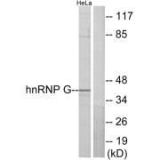 Western blot analysis of extracts from HeLa cells, using hnRNP G antibody.