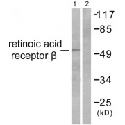 Western blot analysis of extracts from HepG2 cells, using Retinoic Acid Receptor beta antibody (abx013187).