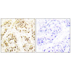 Flap Structure Specific Endonuclease 1 (FEN1) Antibody