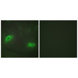 Tumor Necrosis Factor Ligand Superfamily Member 9 (TNFSF9) Antibody