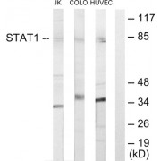 Western blot analysis of extracts from Jurkat cells, COLO205 cells and HUVEC cells, using STAT1 antibody.