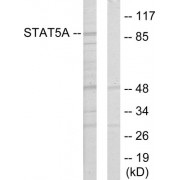 Western blot analysis of extracts from 293 cells, using STAT5A antibody.