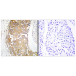 Fyn Related Kinase (FRK) Antibody