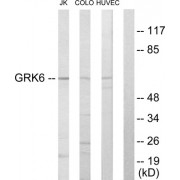 Western blot analysis of extracts from Jurkat cells, COLO205 cells and HUVEC cells, using GRK6 antibody.