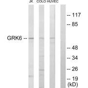 Western blot analysis of extracts from Jurkat cells, COLO205 cells and HUVEC cells, using GRK6 antibody.