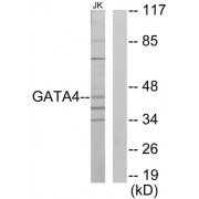 Western blot analysis of extracts from Jurkat cells, using GATA4 antibody.