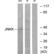Western blot analysis of extracts from Jurkat cells and 293 cells, using JNKK antibody.