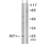Western blot analysis of extracts from Jurkat cells, using RIT1 antibody (abx013189).