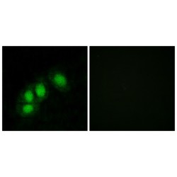 Histidine Triad Nucleotide Binding Protein 1 (HINT1) Antibody