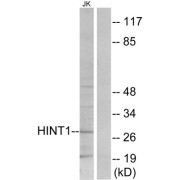 Western blot analysis of extracts from Jurkat cells, using HINT1 antibody.