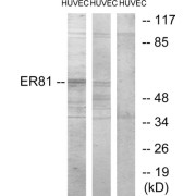 Western blot analysis of extracts from HUVEC cells treated with PMA (125ng/ml, 30mins), and HUVEC cells treated with serum (20%, 30mins), using ER81 antibody.