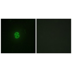 Tumor Necrosis Factor Ligand Superfamily Member 10 (TNFSF10) Antibody