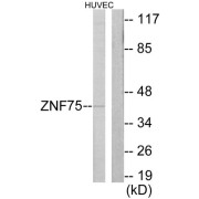 Western blot analysis of extracts from HUVEC cells, using ZNF75 antibody.