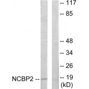 Western blot analysis of extracts from COLO205 cells, using NCBP2 antibody.