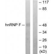 Western blot analysis of extracts from HepG2 cells, using hnRNP F antibody.