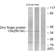 Western blot analysis of extracts from COS-7 cells and K562 cells, using ZNF134 antibody.