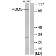 Western blot analysis of extracts from HUVEC cells, using RBM5 antibody.