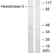 Western blot analysis of extracts from Jurkat cells, treated with insulin (0.01U/ml, 15mins), using Hexokinase-3 antibody.