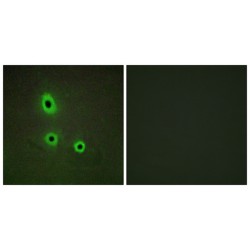 Ephrin A5 (EFNA5) Antibody