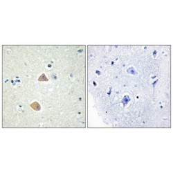 Ephrin A5 (EFNA5) Antibody