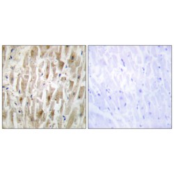 LIM Domain Kinase 2 (LIMK2) Antibody